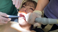 フェチ：歯が染みる～！？歯医者を薦めたら急遽治療決定！！岬あずさ（23）の右下7番う蝕治療＆歯肉炎象牙質過敏症治療