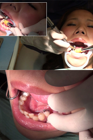 かずみ(25)【歯科治療映像】産後やっとレントゲン！予想以上の崩壊歯に治療方針変更か!?