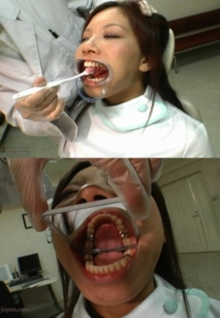 歯科衛生士の口内観察