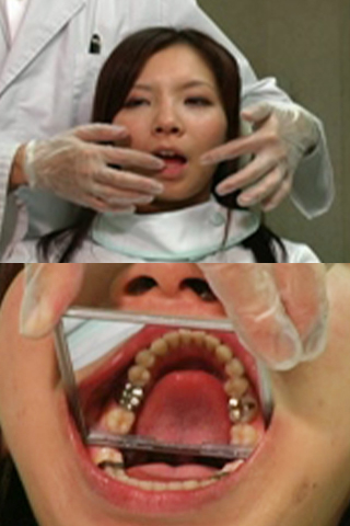 歯科衛生士の口内観察