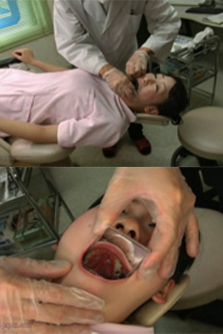歯フェチによる歯観察