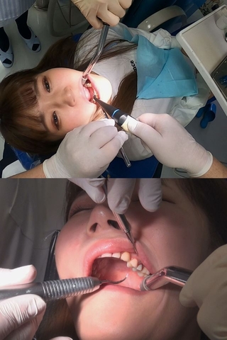 フルクラウン女子まりちゃんの歯科治療‼虫歯み～つけたっ‼